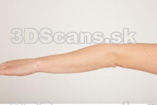 Photo reference of forearm 0001